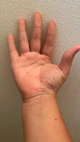 鮮明に捉えられた手のひら