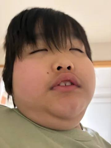 二重顎