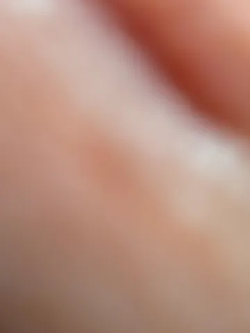肌の微細な世界