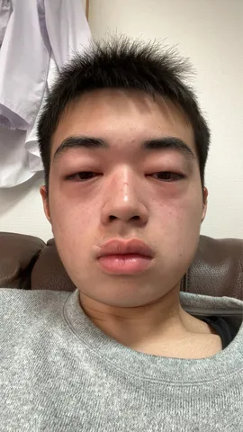 瞼の重さに揺れる日々