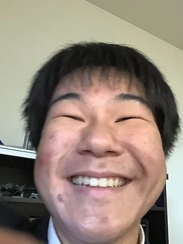 満面の笑みでピースサイン