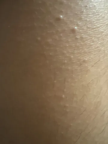 肌の上の小さな輝き